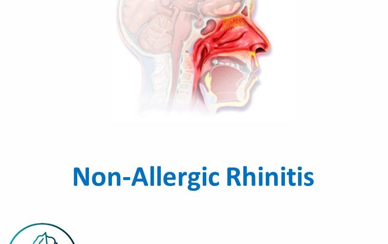 Non-allergic Rhinitis